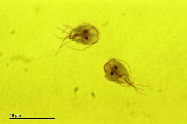 <p>Giardia parasites </p>